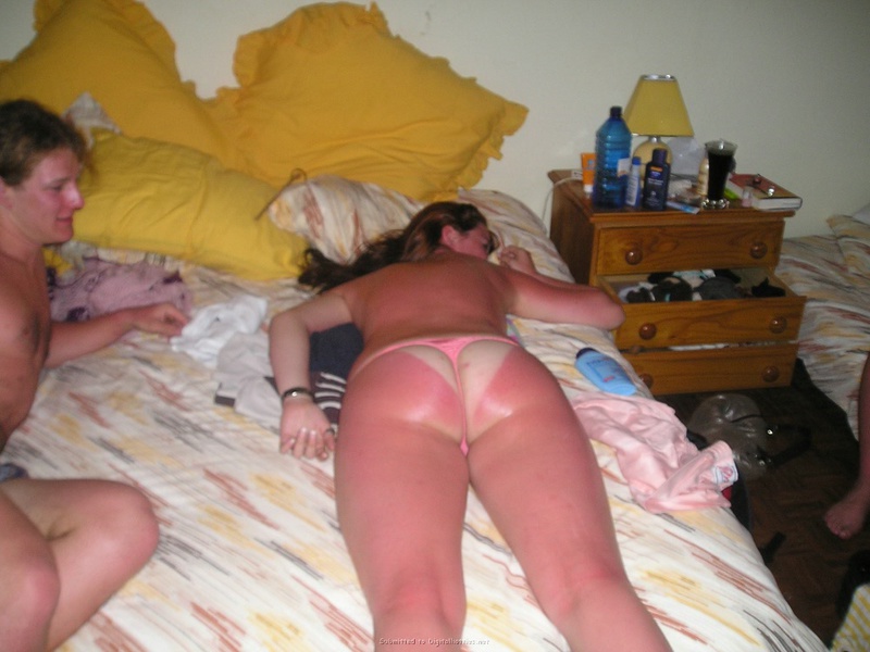 Конопатая сучка сильно обгорела на море 12 фотография